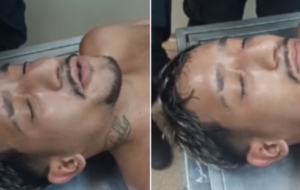 Homem de cabelo platinado com cara de quem está sentindo várias dores