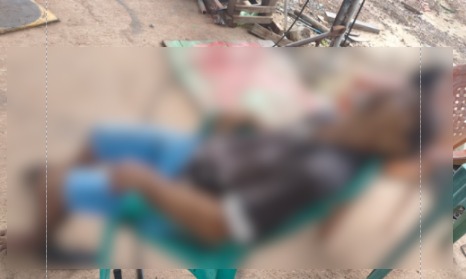 Homem sentado em cadeira, cabeça jogada para trrás. Ele veste bermuda, camisa, boné e chinelo. A foto está embaçada