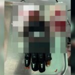 Mão de homem amputada após desentendimento