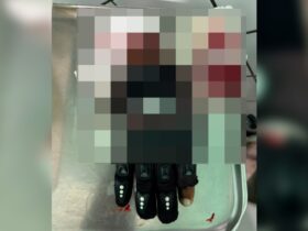 Mão de homem amputada após desentendimento