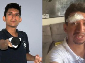 Criador de conteúdo atingido por garrafa