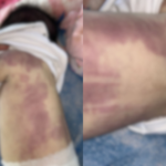 imagens borradas da bebe