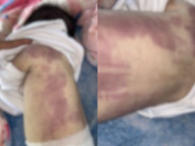 imagens borradas da bebe