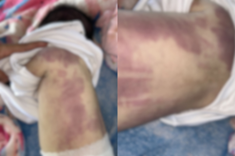 imagens borradas da bebe