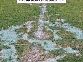 Más condições do estádio Augusto Antunes, em Macapá.