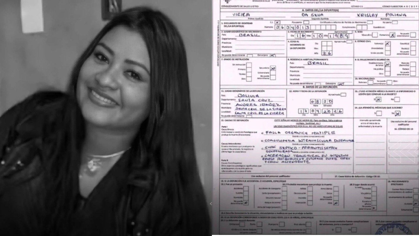 Krisley Poliana morreu na Bolívia após a realização de procedimentos estéticos.