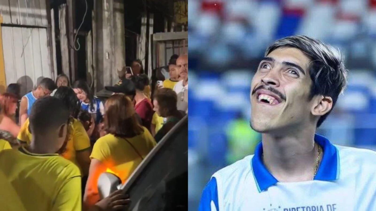 Torcedor símbolo do Paysandu deixou o hospital neste sábado após passar por cirurgia e se recuperar dos ferimentos causados por atropelamento na Sacramenta.