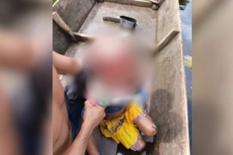 Na imagem em destaque, a vítima do acidente