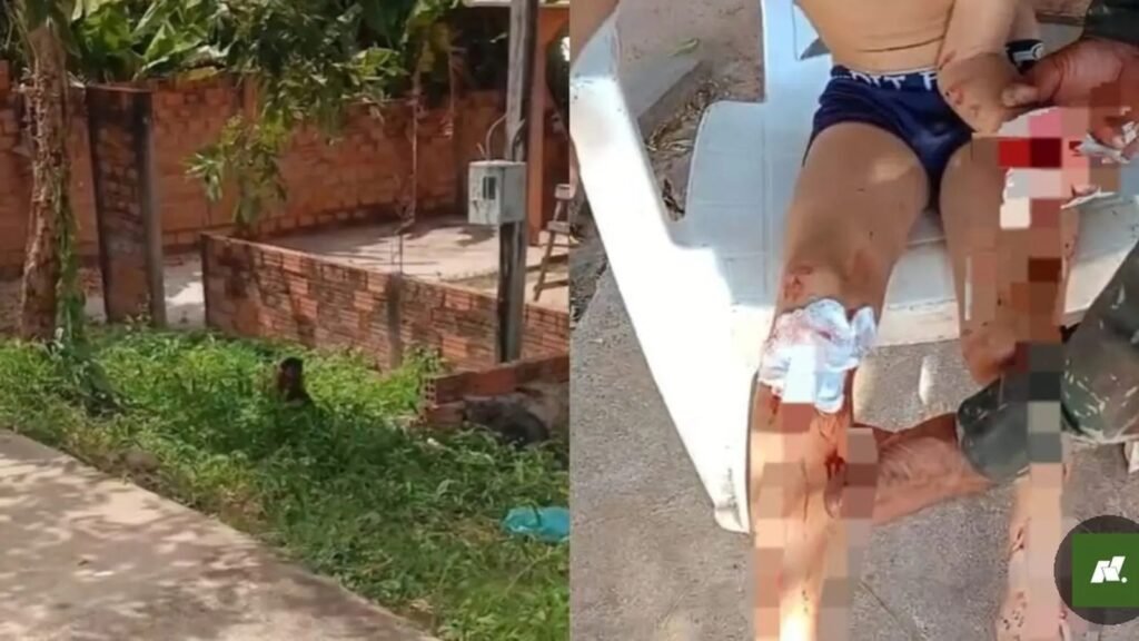 Animal teria avançado contra o menino no bairro Curaxi; moradores afirmam que presença do macaco já havia sido comunicada às autoridades.